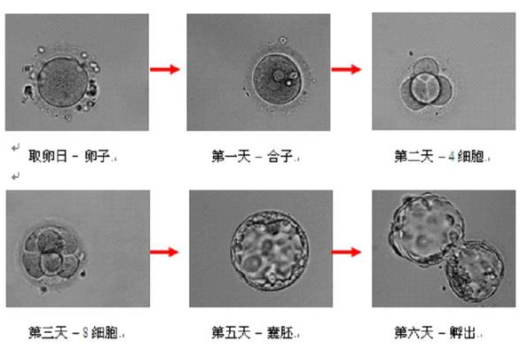 成都第三代助孕包成功靠谱吗